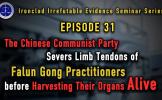 Episode 31: The Chinese Communist Party Severs Limb Tendons of Falun Gong Practitioners before Harvesting Their Organs Alive Episode 31: The Chinese Communist Party Severs Limb Tendons of Falun Gong Practitioners before Harvesting Their Organs Alive